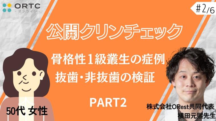 【インビザラインクリンチェック/矯正症例】50歳女性　骨格性1級叢生の症例　抜歯・非抜歯の検証 PART2 横田元熙