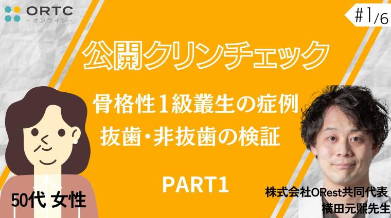 【インビザラインクリンチェック/矯正症例】50歳女性　骨格性1級叢生の症例　抜歯・非抜歯の検証 PART1 横田元熙