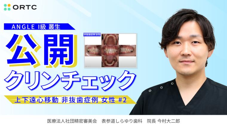 ANGLE　I級　叢生　上下遠心移動　非抜歯症例　女性 今村 大二郎