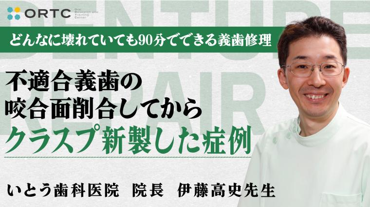不適合義歯の咬合面削合してからクラスプ新製した症例 伊藤高史