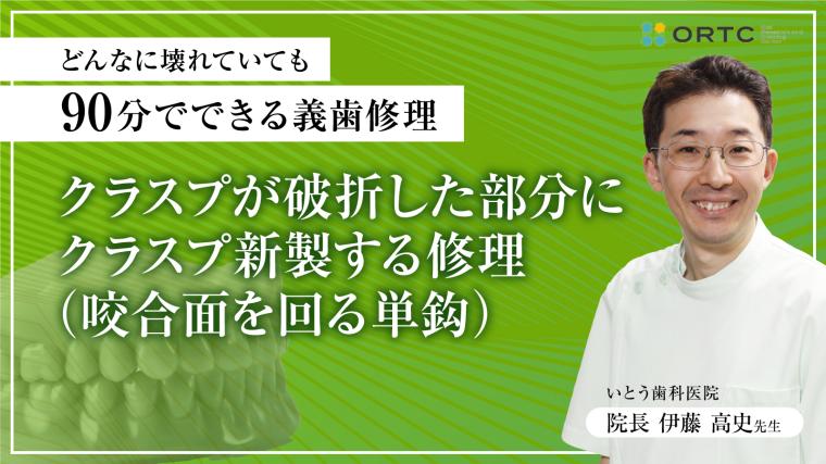 クラスプが破折した部分に、クラスプ新製する修理（咬合面を回る単鈎） 伊藤高史