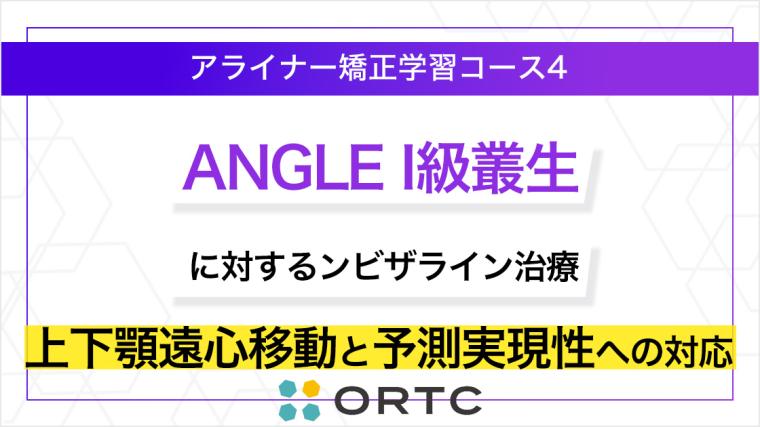 ANGLE I級叢生に対するインビザライン治療：上下顎遠心移動と予測実現性への対応 ORTCアライナー矯正学習コース４