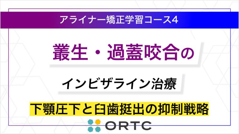 叢生・過蓋咬合のインビザライン治療：下顎圧下と臼歯挺出の抑制戦略 ORTCアライナー矯正学習コース４