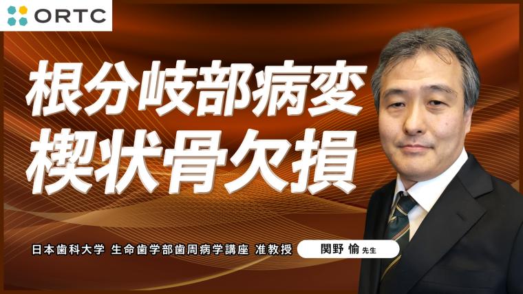 根分岐部病変 楔状骨欠損 関野愉