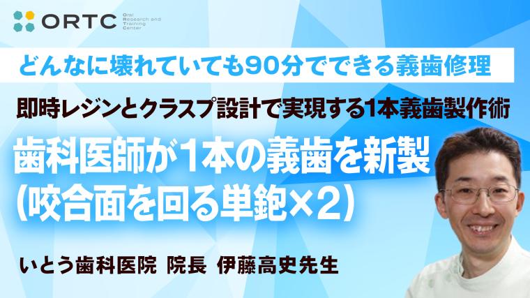 「即時レジンとクラスプ設計で実現する1本義歯製作術」歯科医師が１本の義歯を新製（咬合面を回る単鉋×２） 伊藤高史