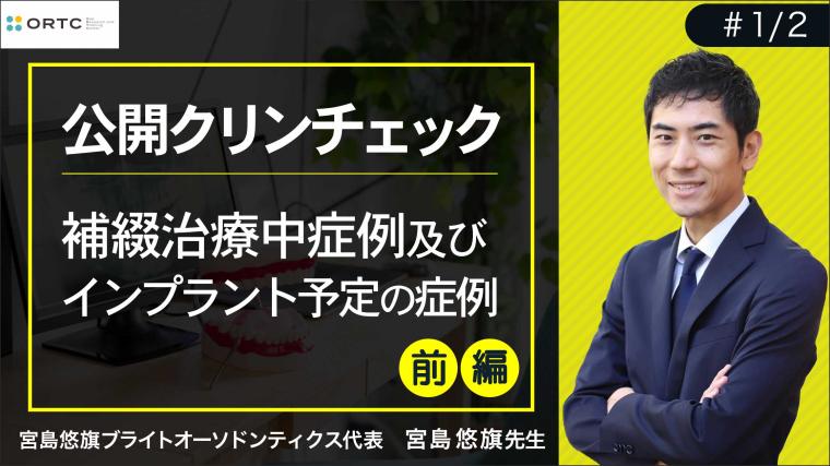 補綴治療中症例及びインプラント予定の症例 宮島悠旗