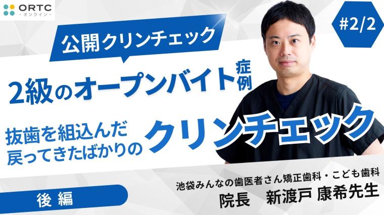 2級のオープンバイト症例_抜歯を組込んだ戻ってきたばかりのクリンチェック2 新渡戸康希