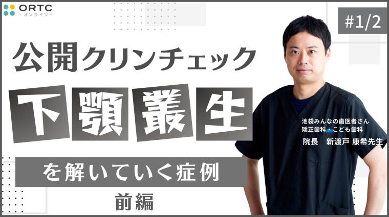 下顎叢生を解いていく症例_公開クリンチェック1 新渡戸康希