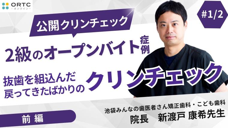 2級のオープンバイト症例_抜歯を組込んだ戻ってきたばかりのクリンチェック1 新渡戸康希