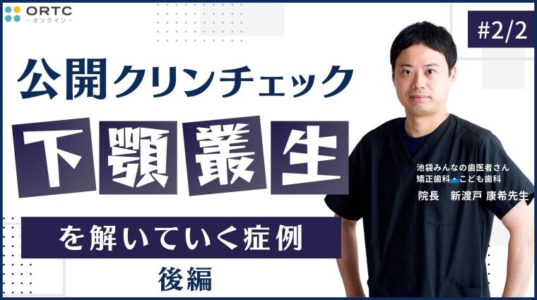 下顎叢生を解いていく症例_公開クリンチェック2 新渡戸康希