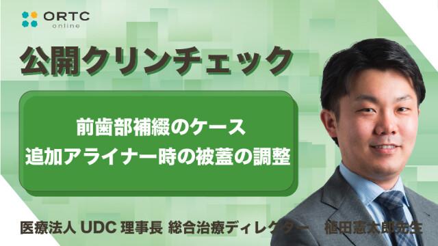 前歯部補綴のケース 追加アライナー時の被蓋の調整 植田憲太郎