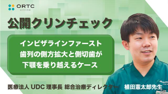 インビザラインファースト 歯列の側方拡大と側切歯の交差咬合（クロスバイト）改善 植田憲太郎