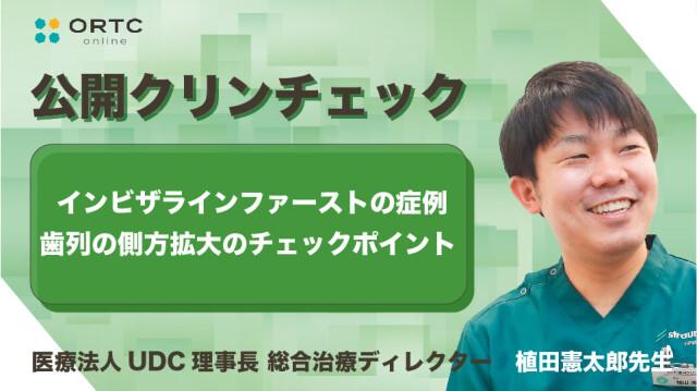 インビザラインファーストの症例 歯列の側方拡大のチェックポイント 植田憲太郎