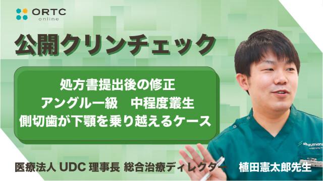処方書提出後の修正 アングル一級　中程度叢生、側切歯の交差咬合（クロスバイト）改善 植田憲太郎