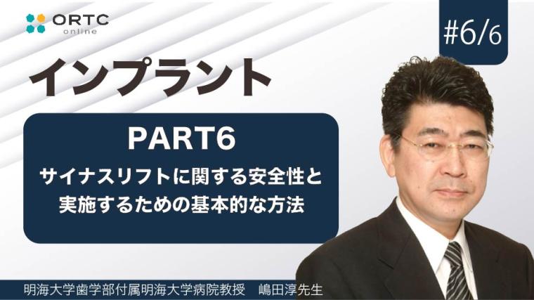 サイナスリフトに関する安全性と実施するための基本的な方法　PART6 嶋田淳