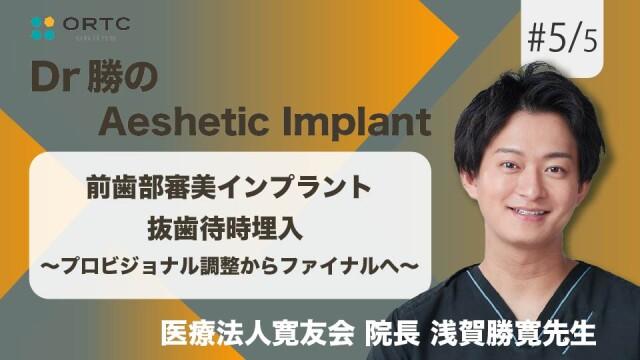 前歯部審美インプラント 抜歯待時埋入   プロビジョナル調整からファイナルへ 浅賀勝寛