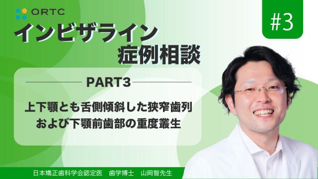 上下顎とも舌側傾斜した狭窄歯列および下顎前歯部の重度叢生PART3 山岡智