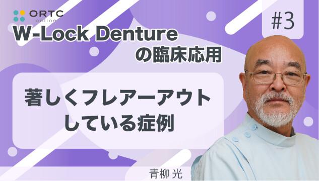 著しくフレアーアウトしている症例 青柳光