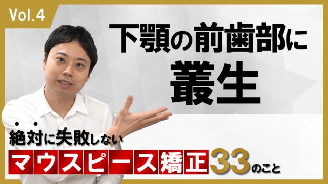 下顎の前歯部に叢生がある場合　絶対に失敗しないマウスピース矯正33のこと 新渡戸康希