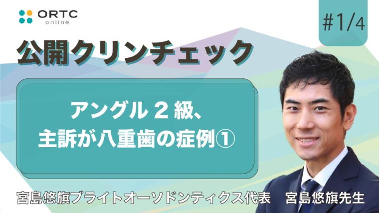 アングル2級、主訴が八重歯の症例 宮島悠旗