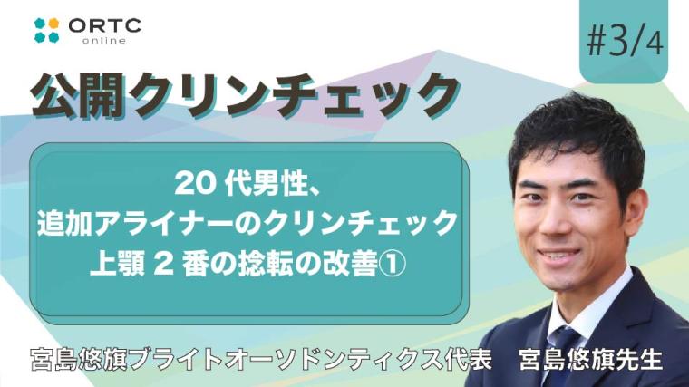 20代男性、追加アライナーのクリンチェック 上顎2番の捻転の改善 宮島悠旗