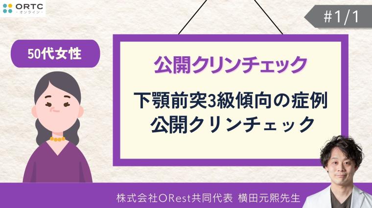 50代女性_下顎前突3級傾向の症例_公開クリンチェック 横田元熙