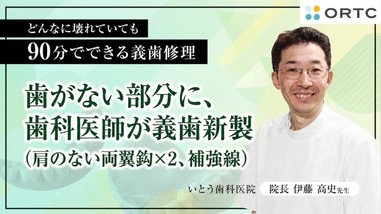 歯がない部分に、歯科医師が義歯新製（肩のない両翼鈎×２、補強線） 伊藤高史