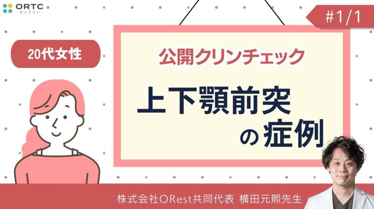 公開クリンチェック_20代女性・上下顎前突の症例 横田元熙