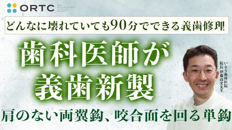 歯科医師が1本義歯新製 （肩のない両翼鈎、咬合面を回る単鈎） 伊藤高史