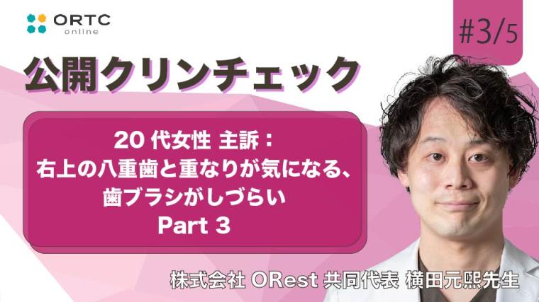 20代女性、主訴：右上の八重歯と重なりが気になる、歯ブラシがしづらい パート3 横田元熙