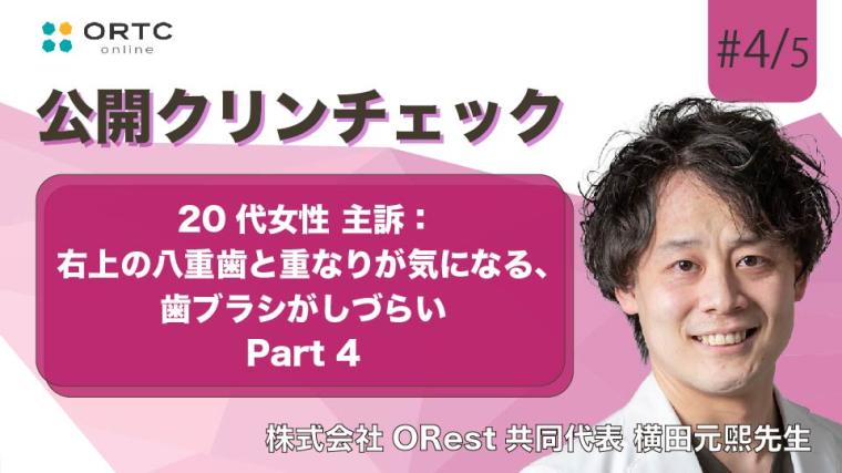 20代女性、主訴：右上の八重歯と重なりが気になる、歯ブラシがしづらい パート4 横田元熙