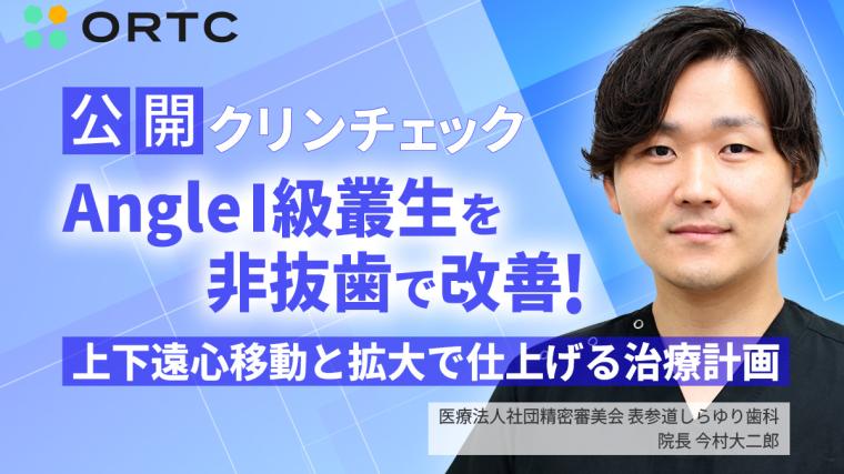 公開クリンチェック Angle1級叢生を非抜歯で改善！上下遠心移動と拡大で仕上げる治療計画	 今村 大二郎