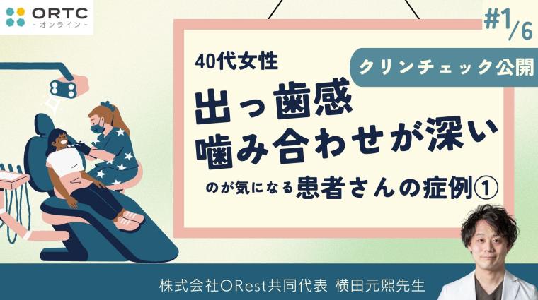 40代女性、出っ歯感、噛み合わせが深いのが気になる患者さんの症例1 横田元熙
