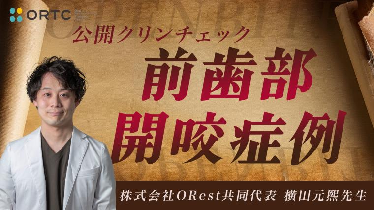 前歯部開咬症例 横田元熙