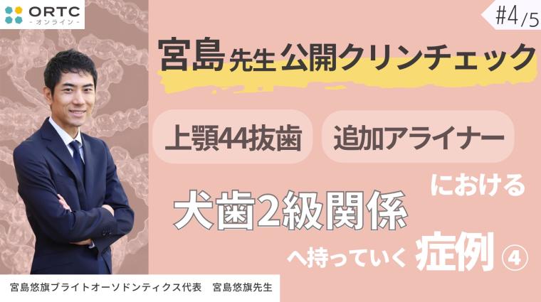 宮島先生公開クリンチェック 上顎44抜歯、追加アライナーにおける犬歯2級関係へ持っていく症例4 宮島悠旗