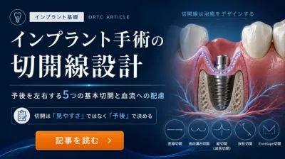 インプラント手術の切開線設計|予後を見据えた5つの基本切開と血流への配慮