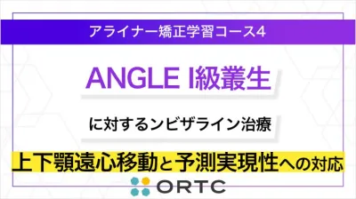 ANGLE I級叢生に対するインビザライン治療：上下顎遠心移動と予測実現性への対応 ORTCアライナー矯正学習コース４