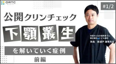 下顎叢生を解いていく症例_公開クリンチェック1 新渡戸康希