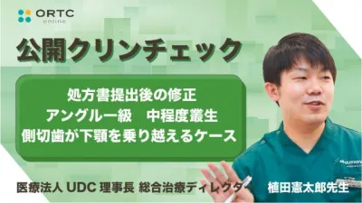 処方書提出後の修正 アングル一級　中程度叢生、側切歯の交差咬合（クロスバイト）改善
