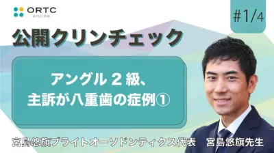 アングル2級、主訴が八重歯の症例 宮島悠旗