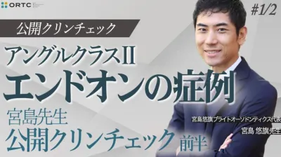 アングルクラス２_エンドオンの症例_宮島先生公開クリンチェック前半 宮島悠旗