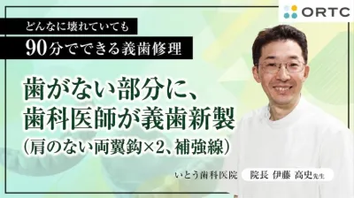 歯がない部分に、歯科医師が義歯新製（肩のない両翼鈎×２、補強線） 伊藤高史