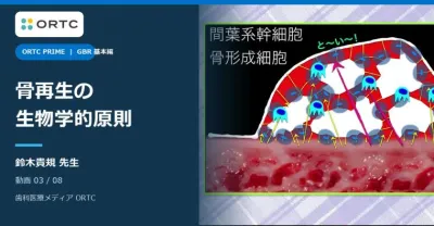 GBRの可能性と必要性 基本編｜骨再生の生物学的原則