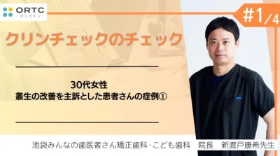 30代女性 叢生の改善を主訴とした患者さんの症例1 新渡戸康希