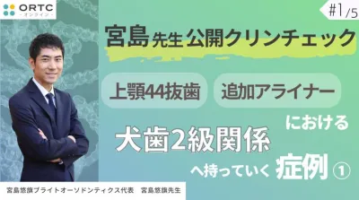 宮島先生公開クリンチェック 上顎44抜歯、追加アライナーにおける犬歯2級関係へ持っていく症例1 宮島悠旗