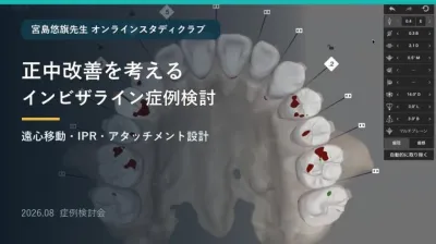 正中改善を考えるインビザライン症例検討｜遠心移動・IPR・アタッチメント設計（2026年8月）